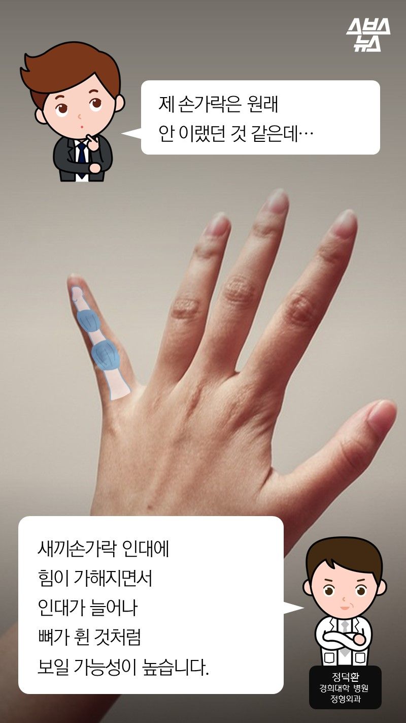 Q. 제 손가락은 원래
안 이랬던 것 같은데…
A. 새끼손가락 인대에
힘이 가해지면서
인대가 늘어나
뼈가 휜 것처럼
보일 가능성이 높습니다.
