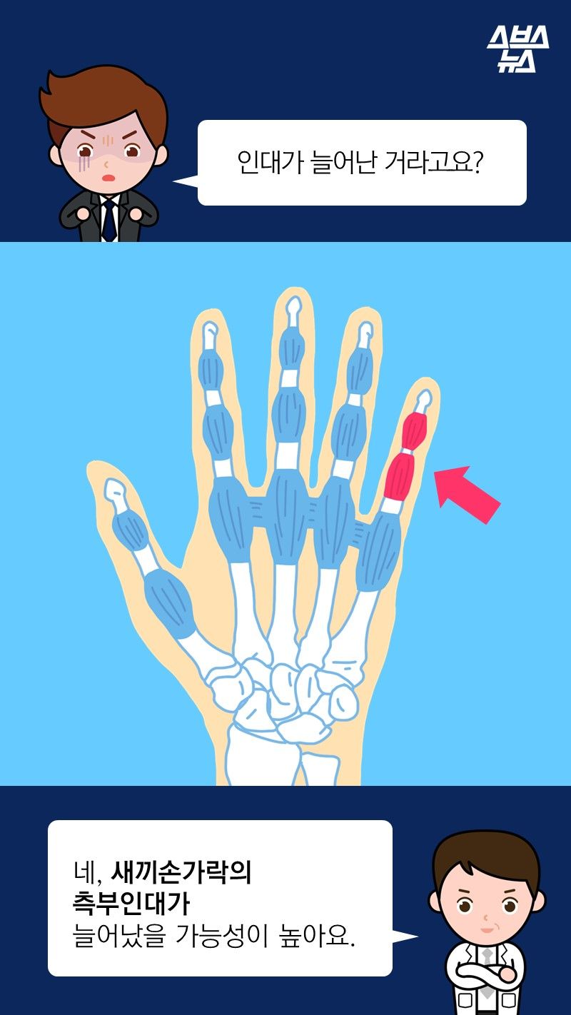 Q. 인대가 늘어난 거라고요?
A. 네, 새끼손가락의
측부인대가
늘어났을 가능성이 높아요. 
