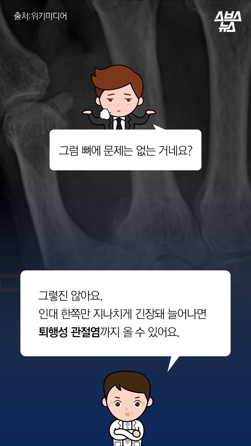 Q. 그럼 뼈에 문제는 없는 거네요?
A. 그렇진 않아요.
인대 한쪽만 지나치게 긴장돼 늘어나면
퇴행성 관절염까지 올 수 있어요.
