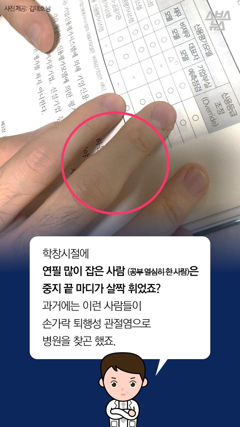 A. 학창시절에
연필 많이 잡은 사람 (공부 열심히 한 사람)은
중지 끝 마디가 살짝 휘었죠?
과거에는 이런 사람들이
손가락 퇴행성 관절염으로
병원을 찾곤 했죠.

