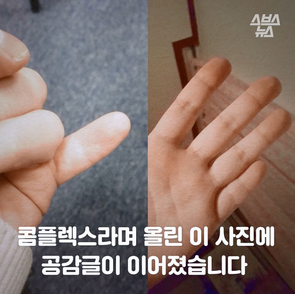 콤플렉스라며 올린 이 사진에
공감글이 이어졌습니다.
