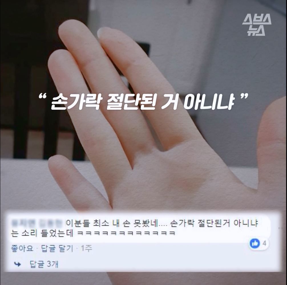 "손가락 절단된 거 아니냐"