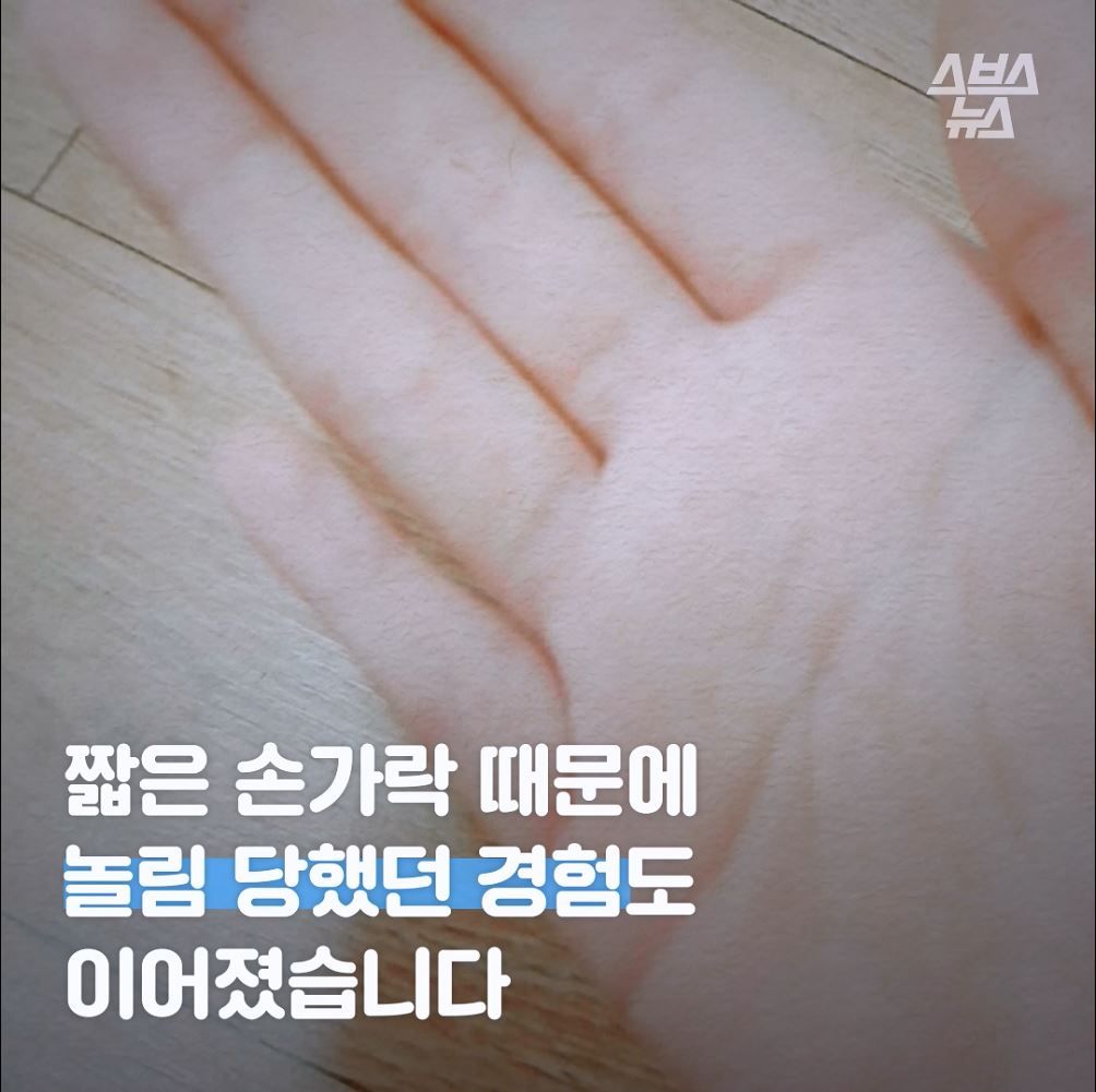 짧은 손가락 때문에 
놀림 당했던 경험도 이어졌습니다
