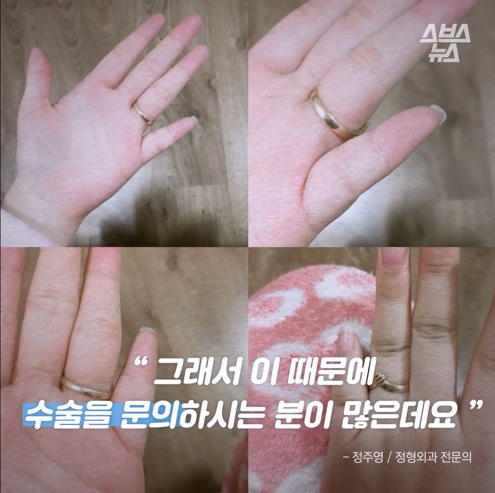 그래서 이 때문에 수술을 문의하시는 분이 많은데요. 