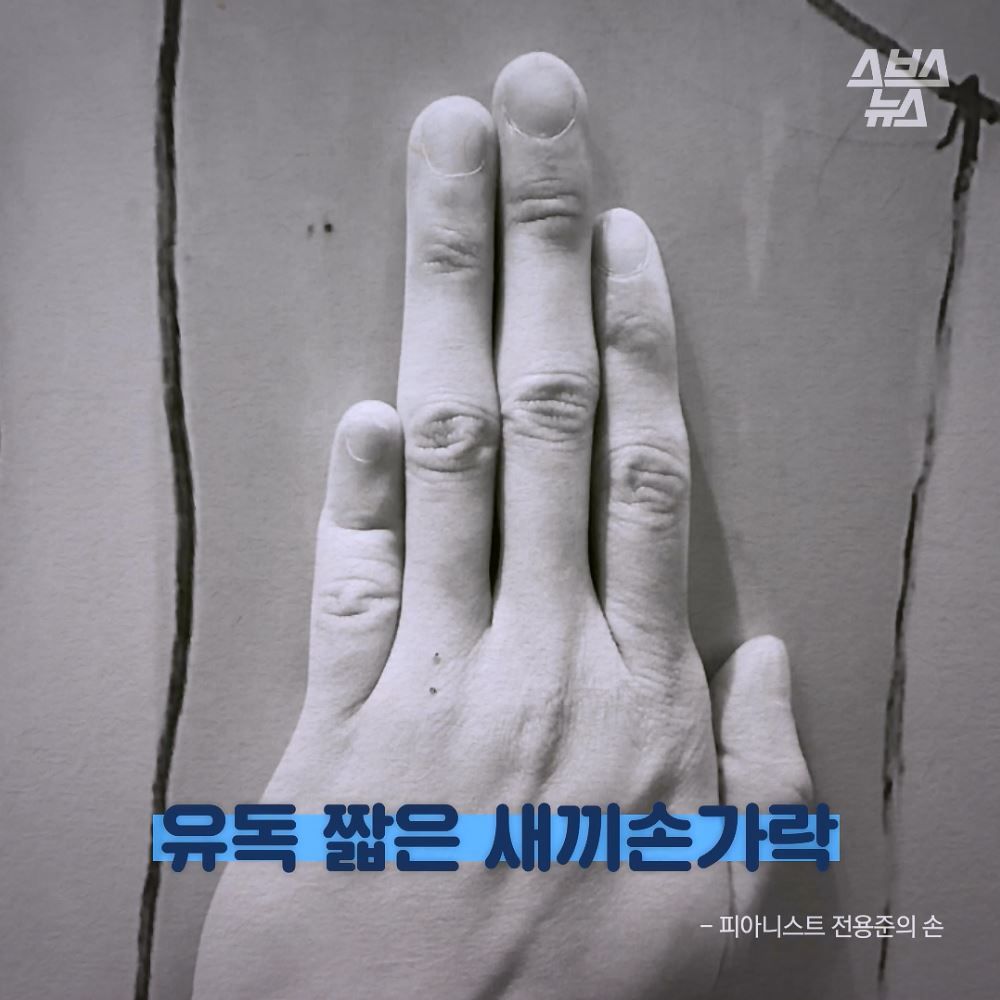 유독 짧은 새끼손가락