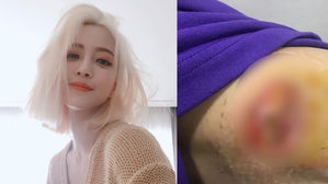 [SBS Star] Han Ye Seul's Heartbreaking Current State of Condition After the Medical Accident