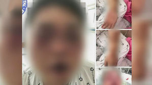 [고현준의 뉴스딱] 택시 잡다 붙은 시비…무차별 집단 폭행으로 실명 위기