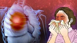 인천 유치원 보조교사 결핵 감염…보건당국 역학조사