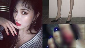 [SBS Star] HyunA Shares What Her Feet Look Like After Performing with High Heels