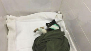 [고현준의 뉴스딱] "개에 총 쏘고 달아난 일당 찾습니다"&hellip;현상금 100만 원