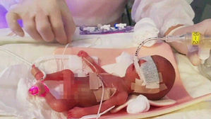 의료진&middot;부모 노력으로&hellip;국내 최소 302g 아기, 건강하게 퇴원