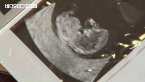 난임 시술 지원 횟수&middot;나이 제한 여전&hellip;"과감한 확대 필요"