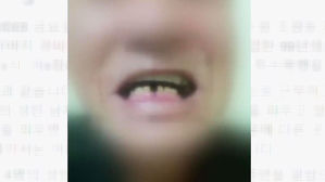 [고현준의 뉴스딱] 만취 10대들 70대 경비원 폭행&hellip;"술에 취해 기억 안 나"