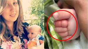 [뉴스pick] 엄마 머리카락 때문에 발가락 절단할 뻔한 아기