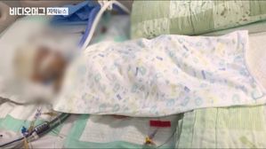 위탁모에 맡긴 두 살 배기 '혼수상태'&hellip;학대 의심