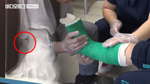"괜찮겠지 뭐" 어릴 적 삐끗한 발목, 그냥 두면 병 키운다