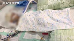 '아기 뇌사' 위탁모 긴급 체포&hellip;단서 된 '사진 두 장'