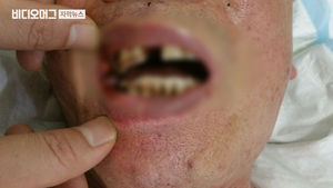 또 만취 주민이 경비원 폭행&hellip;수십 미터 따라가 때렸다