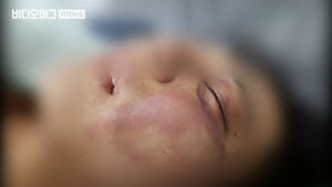 "망치로 맞는다" 대표의 잔혹 폭행&hellip;다리 잃을 뻔한 직원