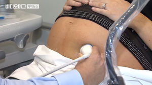 '14년 식물인간' 환자의 출산&hellip;美 경찰 성폭행 수사 착수