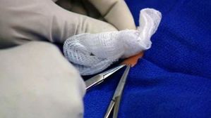 [Pick] 집에서 '포경수술' 받다 숨진 5개월 아기&hellip;"돈 아끼려고"