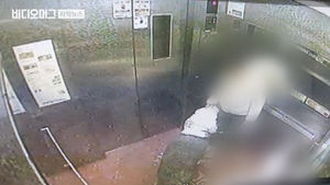 입마개 안 한 대형견에 물린 남성&hellip;상처 봉합수술