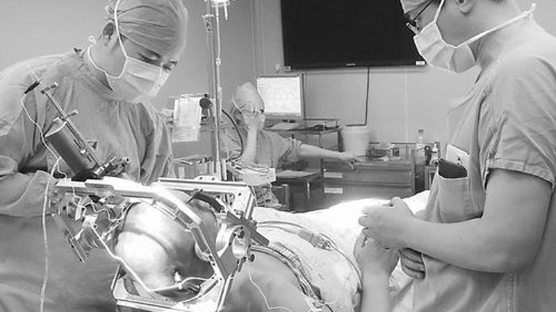 [취재파일] '마약중독자 뇌에 전기칩 심어라