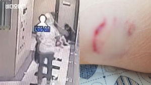 35개월 된 아이 허벅지 문 폭스테리어, 앞서 수차례 약속한 '입마개'는 없었다