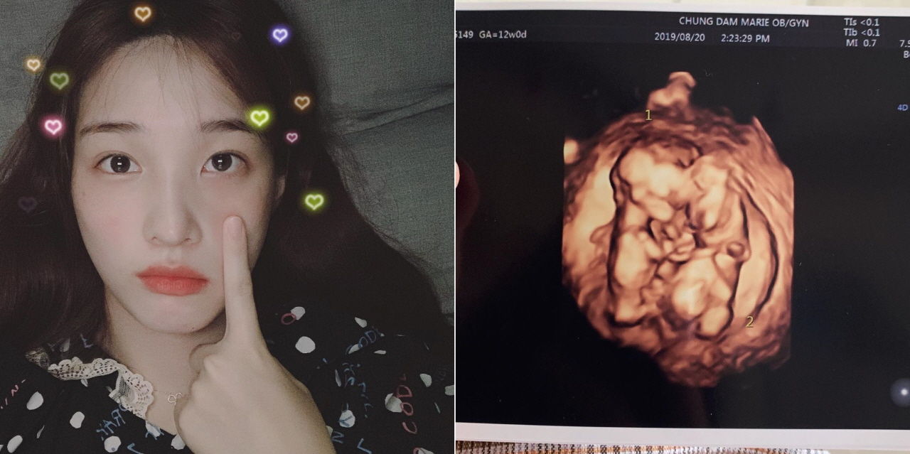 최민환♥율희 '쌍둥이 임신' 소식에 FT아일랜드 멤버들이 보인 반응