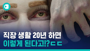 지금 거북목으로 모니터 보고 있습니까?...'20년 뒤' 모습 보여드립니다