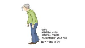 파킨슨병 (사진=서울아산병원, 연합뉴스)