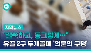"길쭉하고, 동그랗게&hellip;" 유골 2구 두개골에 '의문의 구멍'