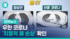 우한 코로나, '치명적 폐 손상' 확인&hellip;中 보고서 입수