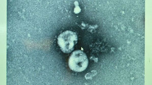 "미 1분기 성장, 코로나19로 최고 0.5%P 타격"