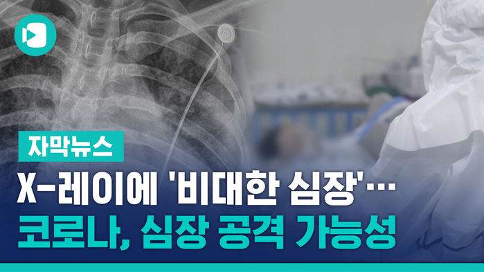 X-레이에 '비대한 심장'&hellip;코로나, 심장 공격 가능성