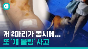 또 '개 물림' 사고&hellip;아파트 안에서 불도그 2마리에 공격 당한 주민