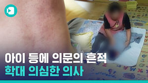 의사가 발견한 학대 정황&hellip;어린이집 CCTV 속 아이는 울고 있었다