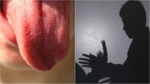 강제 추행 남성 '혀 절단'&hellip;여성이 처벌 안 받는 이유