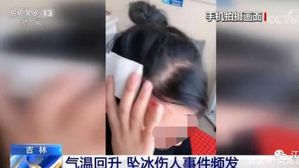 갑자기 떨어진 고드름에 머리 다친 중국 여성 (사진=중국중앙TV 캡처, 연합뉴스)