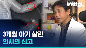 온몸 골절 학대에도 특이체질 주장한 부모&hellip;담당 의사는 아이를 구출했다