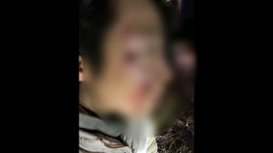 행인 공격 맹견 견주 "잠시 입마개 풀었다가 사고"