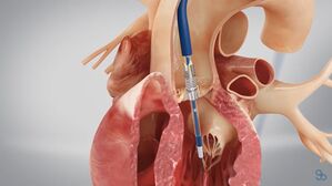 [취재파일] "동의 없이 시술" 폭로에도&hellip;갈 길 먼 '통합 진료'