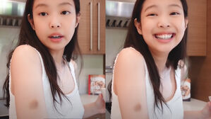 [SBS Star] VIDEO: BLACKPINK JENNIE Explains How She Got a Big Bruise on Her Arm