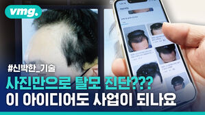 신박한 기술
사진만으로 탈모 진단???
이 아이디어도 사업이 되나요