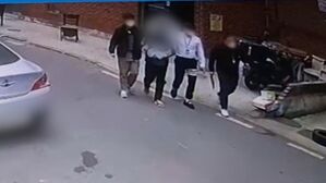 [D리포트] 생후 1개월 딸 때려 두개골 골절…친부 구속