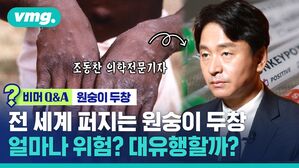 [비머 Q&A] 전 세계 퍼지는 '원숭이 두창'&hellip;얼마나 위험? 대유행할까?