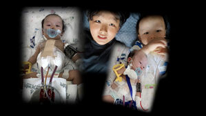 심장병 아기의 400일의 기적