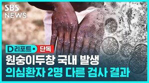 D리포트 단독 원숭이두창 국내 발생 의심환자 2명 다른 검사 결과