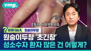 비머 Q&A 원숭이두창 원숭이두창 '초긴장' 성소수자 환자 많은 건 어떻게?