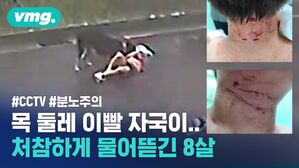 목 둘레 이빨 자국이.. 처참하게 물어뜯긴 8살